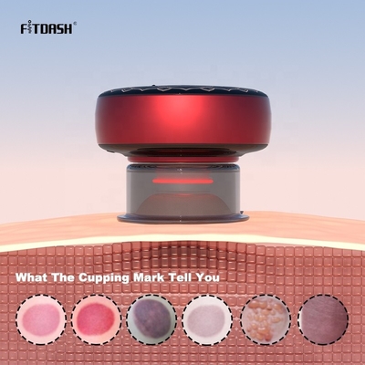 Революционируйте свой массаж с помощью Fitdash Rhythmic Cupping Massage Smart Cupping