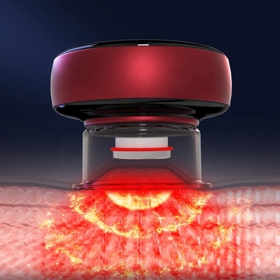 Fitdash Cuppers Физиотерапевтические инструменты для капель
