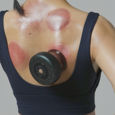 Беспроводный Fitdash Smart Moxibustion Cupping Massager с инфракрасным тепловым вакуумным кубком